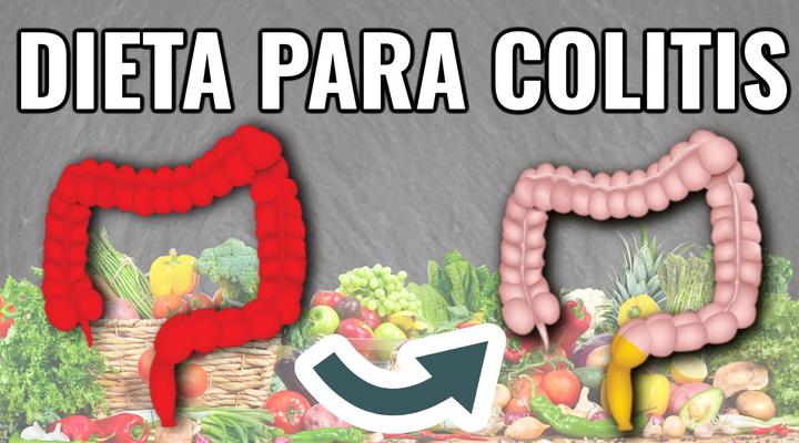 Esto es lo que no debés comer si tenés colitis