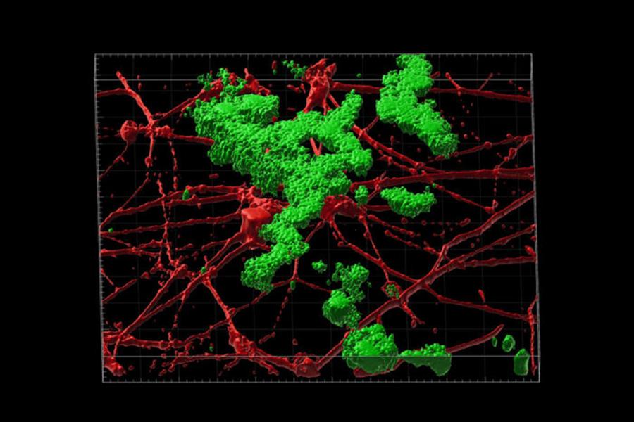 Reconstrucción en 3D de la deposición de placas de beta amiloide (verde) entre neuronas (rojo) cultivadas en el laboratorio. / EFE