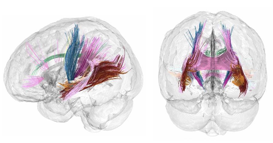 El cerebro de la mujer reduce su tamaño durante el embarazo./ EFE