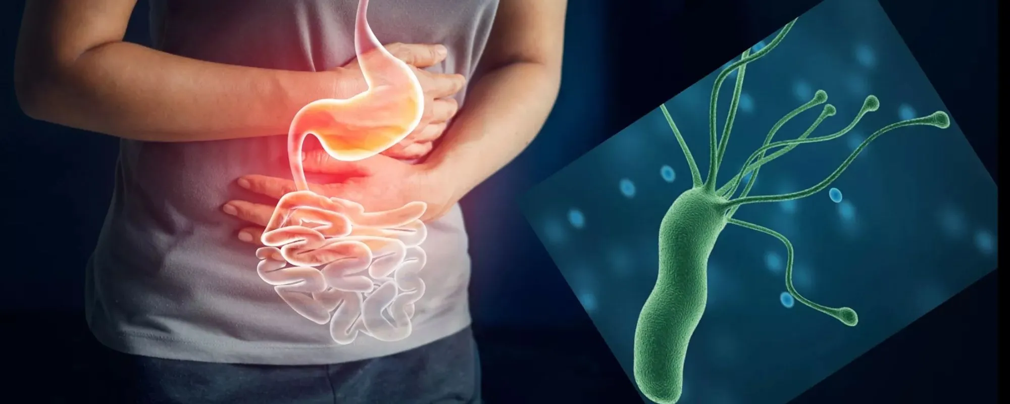 Helicobacter pylori, la bacteria silenciosa que puede afectar el ...